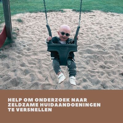 Help om onderzoek naar zeldzame huidaandoeningen te versnellen